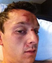 The Poker Grapevine – Sam Trickett Assaulted